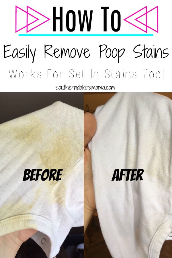 How To Get Poop Stains Out Of Clothes, Furniture, & More