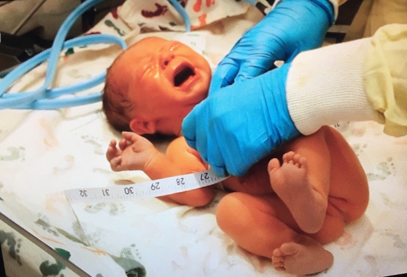 Newborn is measured by nurse and receives post birth treatments and screenings.